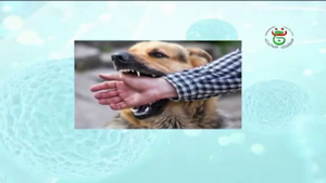 ريبورتاج للتلفزيون الجزائري حول داء الكلب، مختصيين من معهد البيطرة جامعة البليدة 1